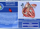 El infarto de miocardio | Recurso educativo 36003