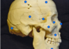 Skull lateral bones | Recurso educativo 60313