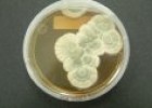 El papel de los microorganismos | Recurso educativo 61977