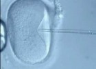 Fecundació in vitro | Recurso educativo 732683