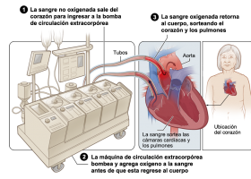 Bomba extracorpórea. | Recurso educativo 7903458